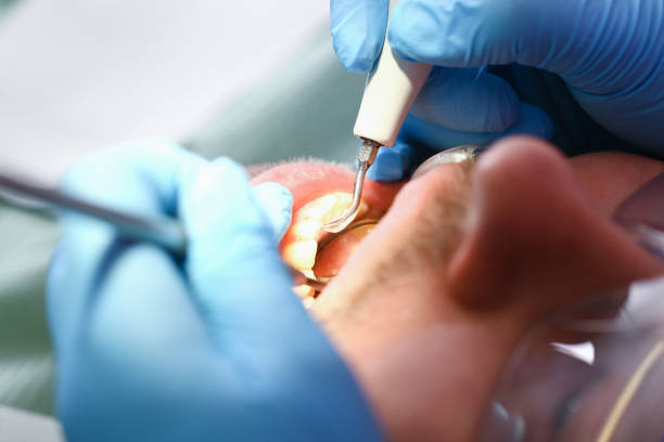 Best Emergency Dental Care for Abscessed Tooth in Corydon, IA